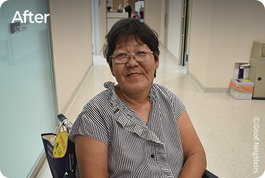 치료 받은 후 사진